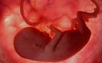 Los 10 principales argumentos contra el aborto y topicos pro aborto